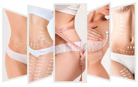 Liposuction Yağ Aldırma Nedir?